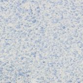 Жидкие обои Рельеф Г-326*